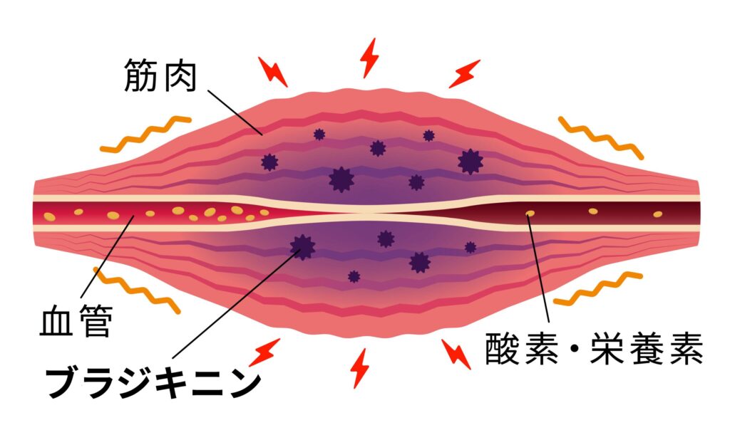 ブラジキニンの図